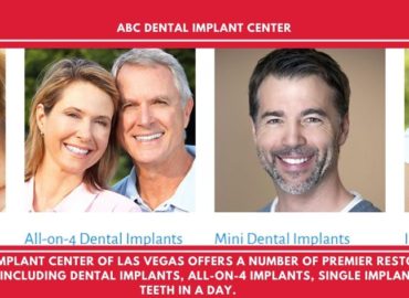 REMOVABLE DENTURES SERVICES IN LAS VEGAS