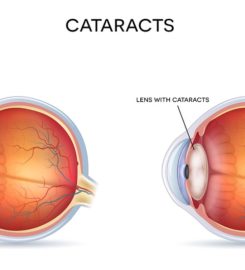 Ava Eye Clinic