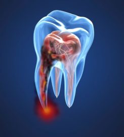 Dentist Brooklyn | Eco Dental