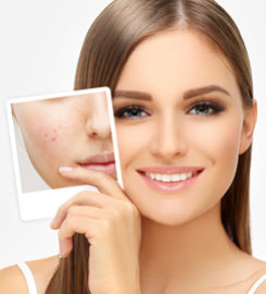 Cosmetic Botox Injection