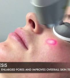 Cosmetic Botox Injection