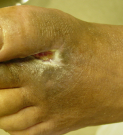 Releford Foot and Ankle Institute