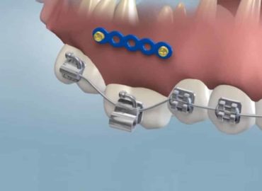 Moody Orthodontics