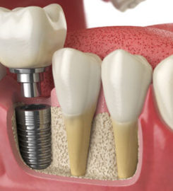 Bakerview Dental Centre
