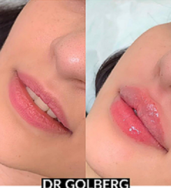 Botox Treatment Long Island