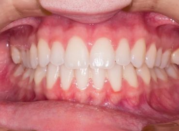 Complete Health Dentistry of NEPA