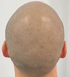 The Perfect MicroHair