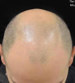 The Perfect MicroHair