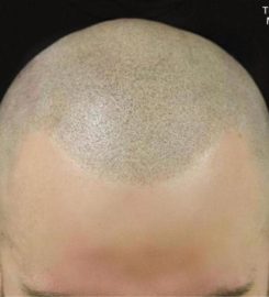 The Perfect MicroHair