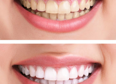Chico Dental Arts