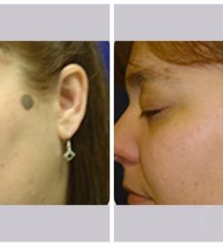 Infini Cosmetic Associates