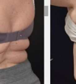 Skin Retouch MediSpa