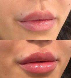 Skin Retouch MediSpa