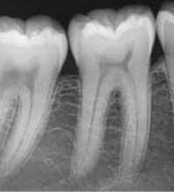 Maxwell Heights Dental