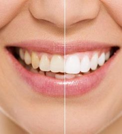Broadway Cosmetic Dentistry PC