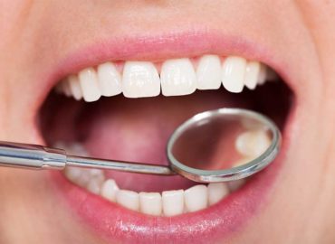 Your Gold Coast Dentist