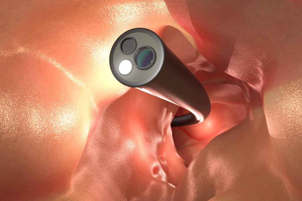 Endoscopy Brownsville
