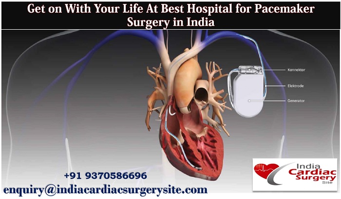 Get on With Your Life At Best Hospital for Pacemaker Surgery in India