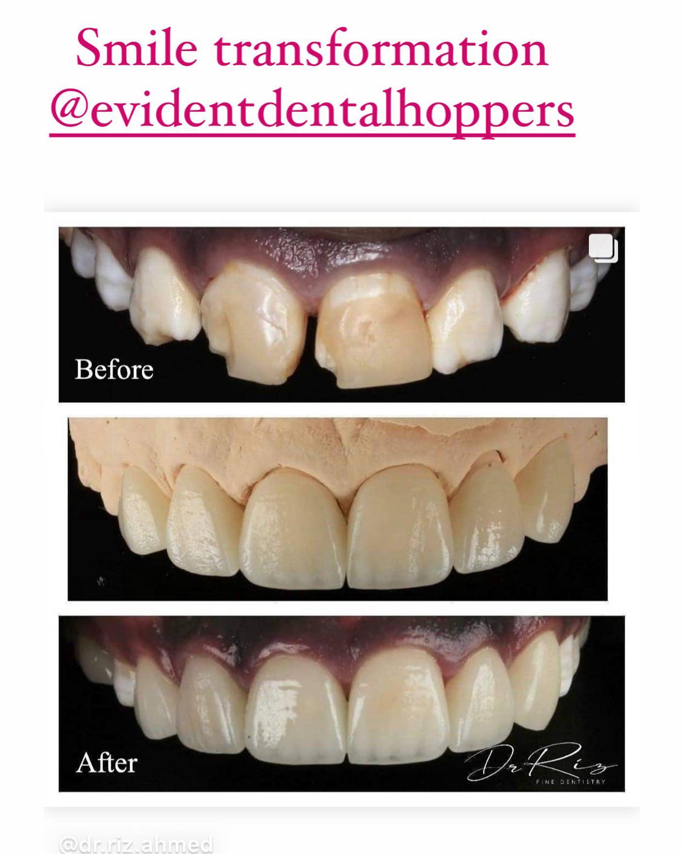 Hoppers Crossing Family Dentist