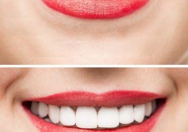 W. Gregory Rose DDS, PA