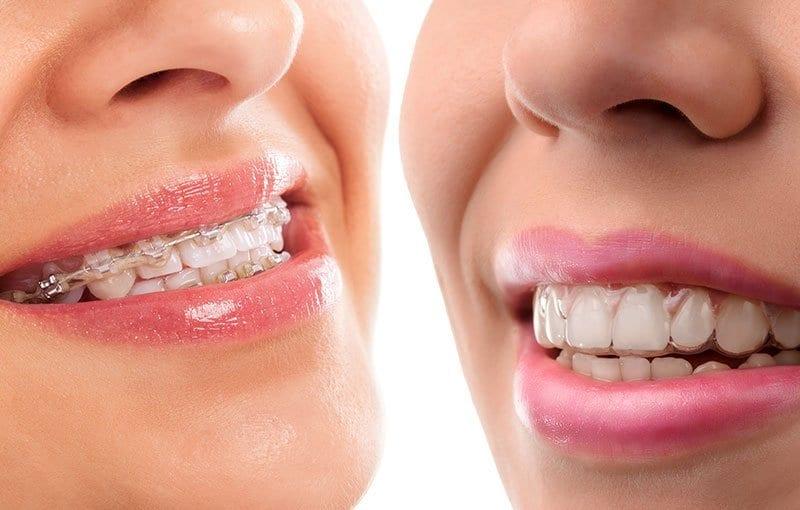 Schaumburg Dentistry