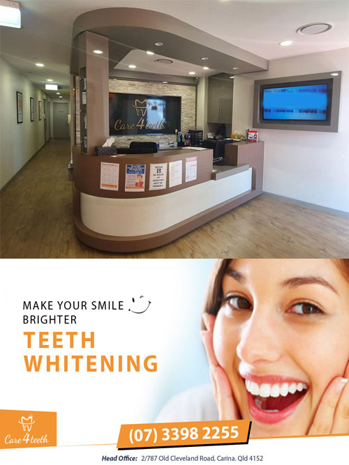 Teeth Whitening Carina, Brisbane | Brisbane Teeth Whitening ̵ &hellip;