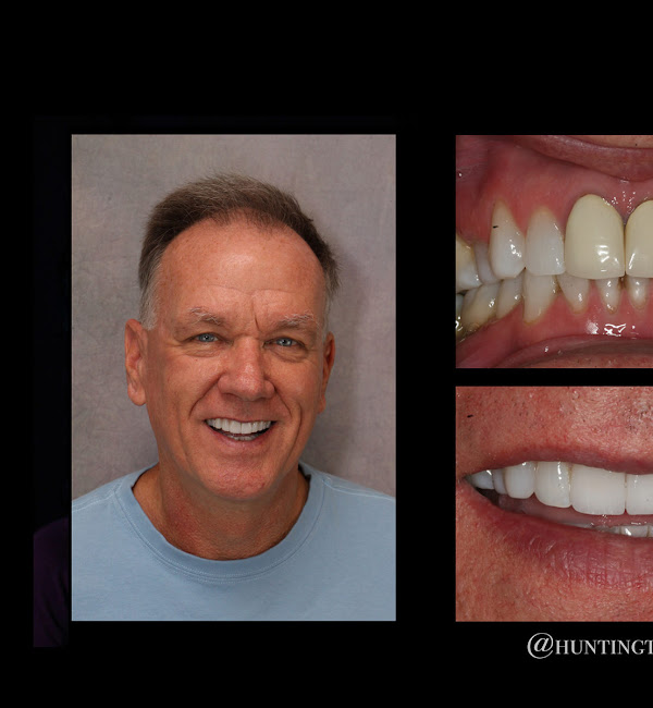 Huntington Bay Dental