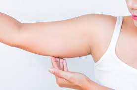 Arm Lift Surgery in Dubai