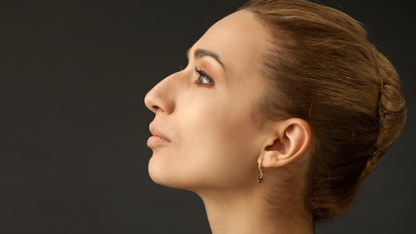 Rhinoplasty in Dubai