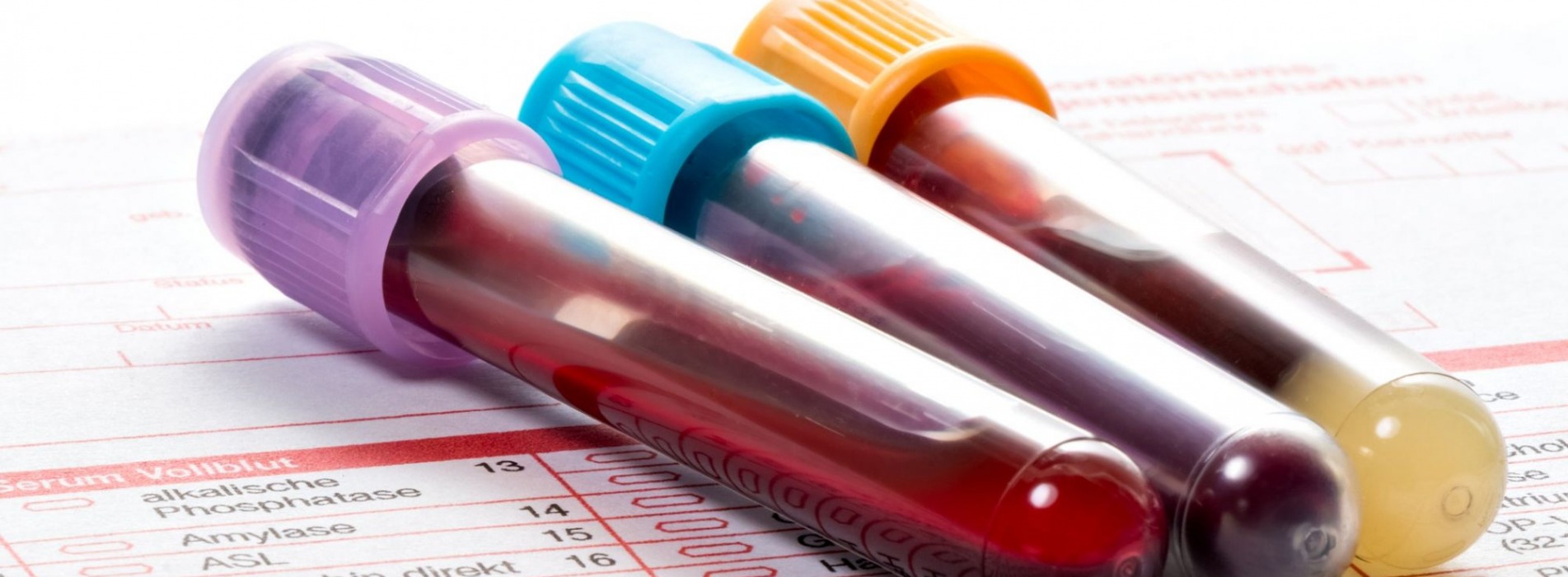 Peace of Mind Mobile Phlebotomist LLC