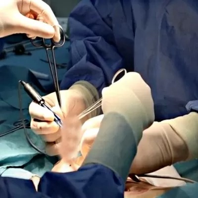 Male Circumcision in Dubai
