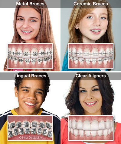 Wermerson Orthodontics