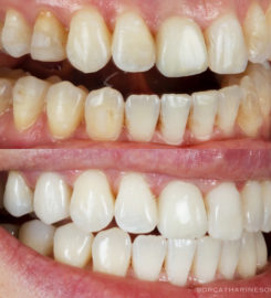 Song Cosmetic Dentistry Beverly Hills