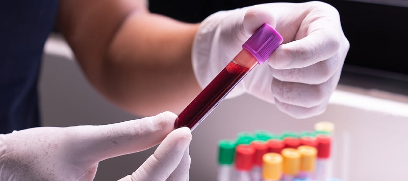 Phlebotomy Now