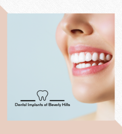 Dental Implants of Beverly Hills