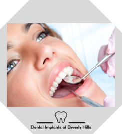 Dental Implants of Beverly Hills
