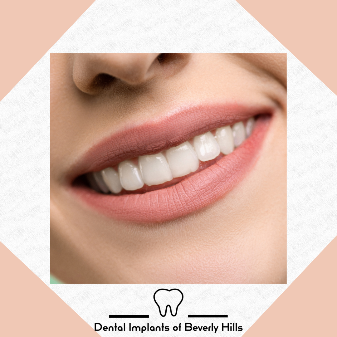Dental Implants of Beverly Hills