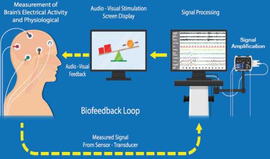 Neurofeedback San Diego