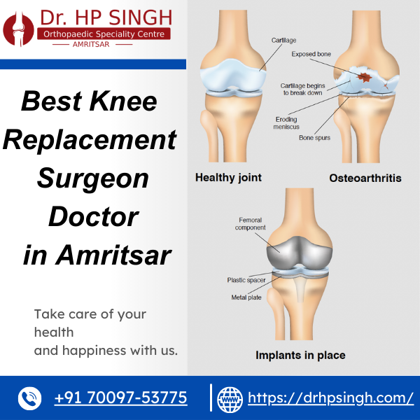 Best Knee Replacement Surgeon Doctor in Amritsar