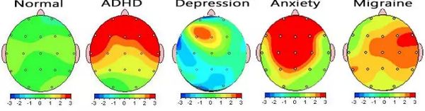 Brain Health Center