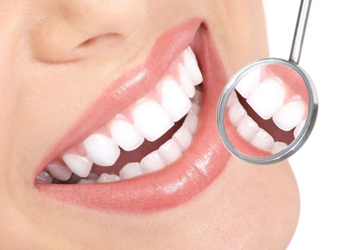 Emergency Dentist Houston