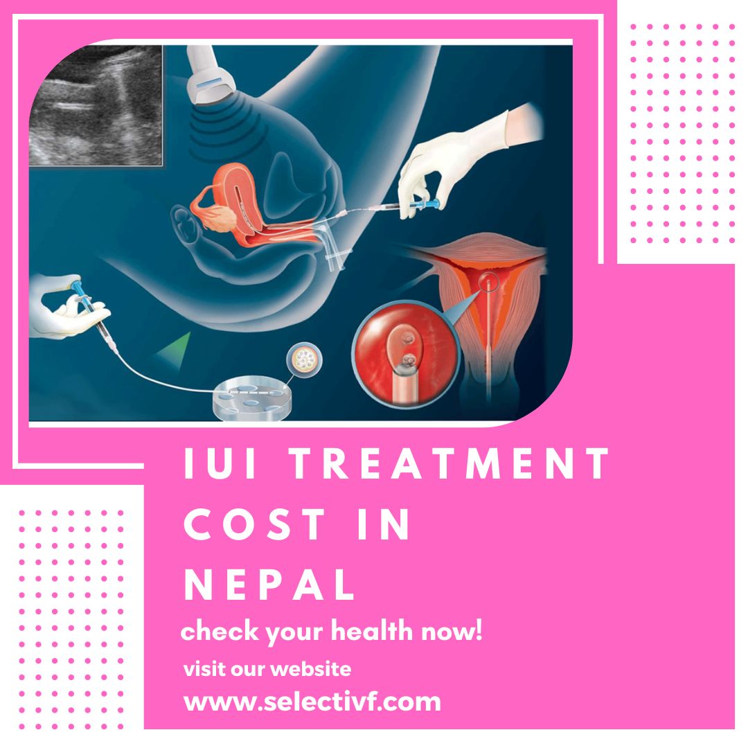 IUI Treatment Cost in Nepal
