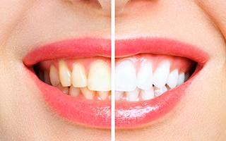 Pradham Dental – Kondapur