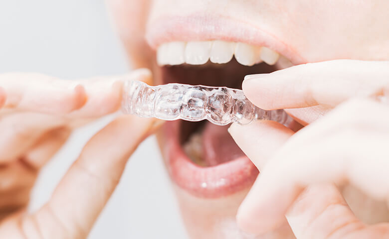 Flash Dental