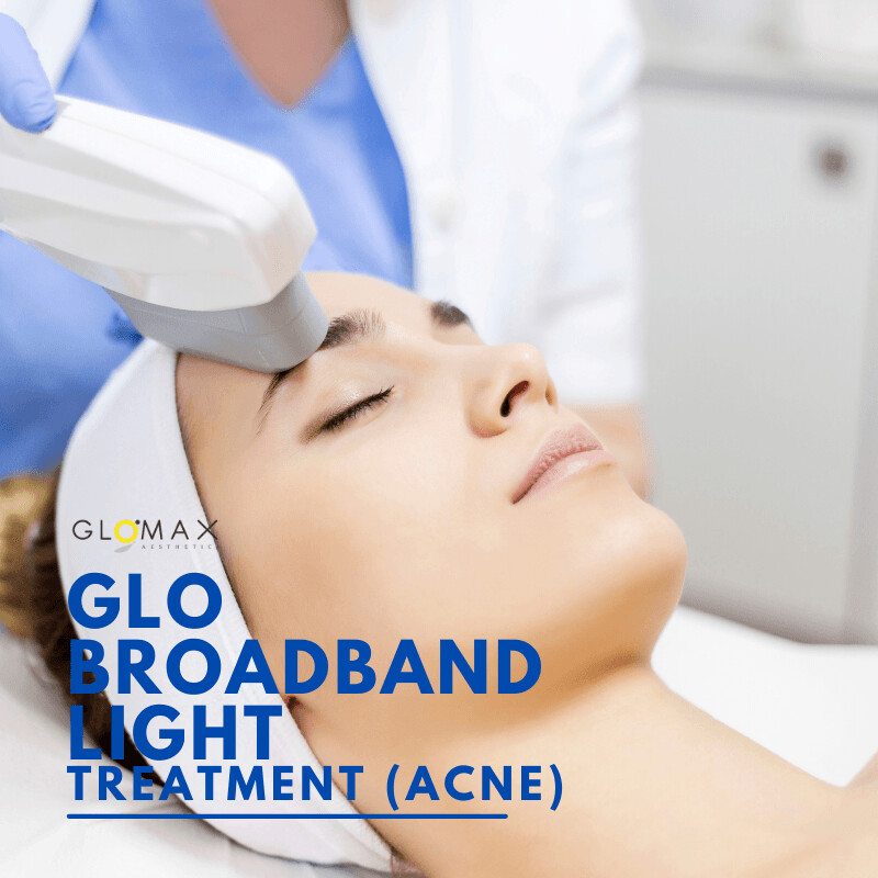 Anti Acne Treatment in Singapore