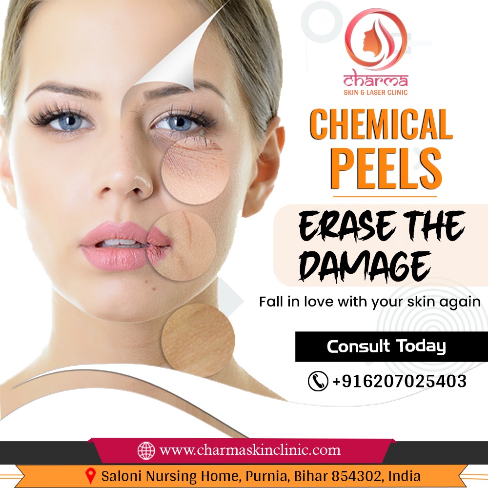 Charma Skin & Laser Clinic | laser skin care centre in Purnia &hellip;