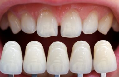 The Lakewood Dentist