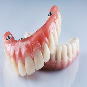 Dental Implants of Dallas