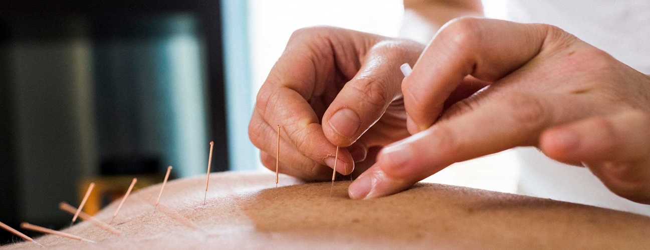 Healing Way Acupuncture