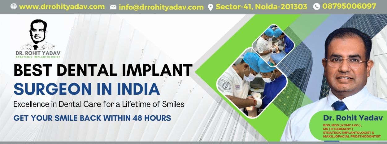 No Bone Case By Dr. Rohit Yadav